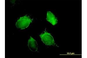 Immunofluorescence of purified MaxPab antibody to HNRPD on HeLa cell. (HNRNPD/AUF1 antibody  (AA 1-355))