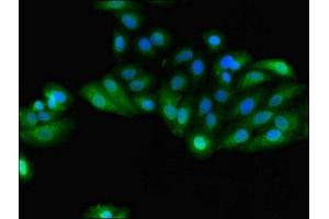 Immunofluorescent analysis of HepG2 cells using ABIN7154093 at dilution of 1:100 and Alexa Fluor 488-congugated AffiniPure Goat Anti-Rabbit IgG(H+L) (GSTA4 antibody  (AA 1-222))
