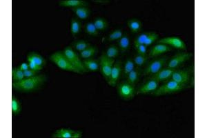 Immunofluorescent analysis of HepG2 cells using ABIN7154093 at dilution of 1:100 and Alexa Fluor 488-congugated AffiniPure Goat Anti-Rabbit IgG(H+L) (GSTA4 antibody  (AA 1-222))