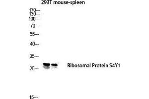 Western Blot (WB) analysis of 293T Mouse Spleen lysis using Ribosomal Protein S4Y1 antibody. (Ribosomal Protein S4Y1 (C-Term) antibody)
