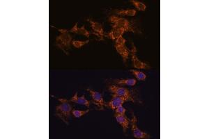 Immunofluorescence analysis of C6 cells using PYCR2 antibody (ABIN7269766) at dilution of 1:100.
