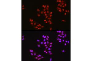 Immunofluorescence analysis of HeLa cells using T antibody (ABIN7270715) at dilution of 1:25.