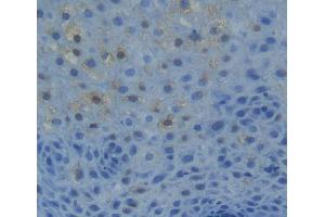 Used in DAB staining on fromalin fixed paraffin- embedded liver tissue (NR1H2 antibody  (AA 1-446))