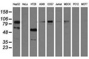 Image no. 1 for anti-phosphoinositide-3-Kinase Adaptor Protein 1 (PIK3AP1) antibody (ABIN1496826) (PIK3AP1 antibody)