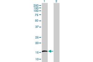 Western Blot analysis of EMP3 expression in transfected 293T cell line by EMP3 MaxPab polyclonal antibody.