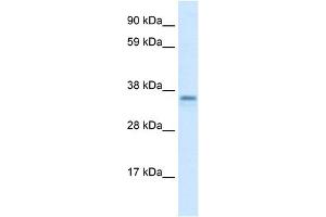 WB Suggested Anti-CGI-62 Antibody Titration:  1. (FAM164A antibody  (C-Term))