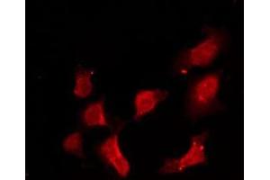 ABIN6275172 staining HeLa by IF/ICC. (RRAD antibody  (Internal Region))