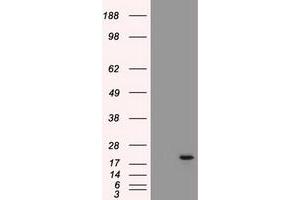 HEK293T cells were transfected with the pCMV6-ENTRY control (Left lane) or pCMV6-ENTRY AK1 (Right lane) cDNA for 48 hrs and lysed. (Adenylate Kinase 1 antibody)