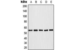 Western blot analysis of AKT (pT308) expression in HeLa colchicine-treated (A), HL60 (B), NIH3T3 (C), SP2/0 colchicine-treated (D), PC12 colchicine-treated (E) whole cell lysates. (AKT1 antibody  (pSer308))