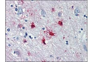 Human Brain, cortex: Formalin-Fixed, Paraffin-Embedded (FFPE) (alpha 1 Adrenergic Receptor antibody  (AA 206-270))
