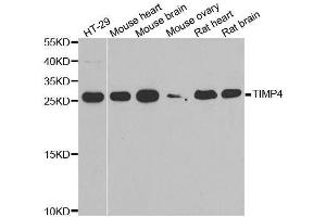 Western blot analysis of extracts of various cell lines, using TIMP4 antibody. (TIMP4 antibody  (AA 30-224))