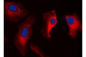 Immunofluorescent analysis of MAST3 staining in HepG2 cells. (MAST3 antibody  (C-Term))
