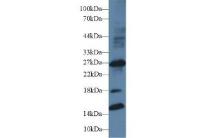Detection of IGFBP1 in Human Placenta lysate using Polyclonal Antibody to Insulin Like Growth Factor Binding Protein 1 (IGFBP1) (IGFBPI antibody  (AA 112-262))