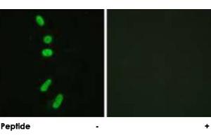 Immunofluorescence analysis of HeLa cells, using SF1 polyclonal antibody .