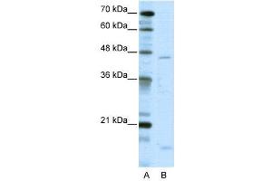 WB Suggested Anti-TRIP13  Antibody Titration: 5. (TRIP13 antibody  (C-Term))