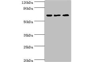 Western blot All lanes: PIAS2 antibody at 2 μg/mL Lane 1: A431 whole cell lysate Lane 2: HepG2 whole cell lysate Lane 3: Mouse brain tissue Secondary Goat polyclonal to rabbit IgG at 1/10000 dilution Predicted band size: 69, 64, 46 kDa Observed band size: 69 kDa (PIAS2 antibody  (AA 532-621))