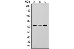 Western blot analysis of CD73 expression in HepG2 (A), K562 (B), A375 (C) whole cell lysates. (CD73 antibody  (Center))