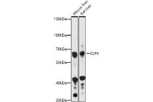 Western blot analysis of extracts of various cell lines, using CLPX antibody (ABIN7266418) at 1:1000 dilution. (CLPX antibody  (AA 500-600))