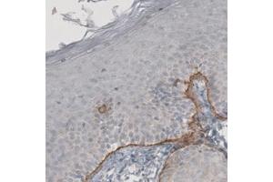 Immunohistochemical staining (Formalin-fixed paraffin-embedded sections) of human skin with LAMC2 monoclonal antibody, clone CL2980  shows strong immunoreactivity in basement membrane of squamous epithelium. (LAMC2 antibody)