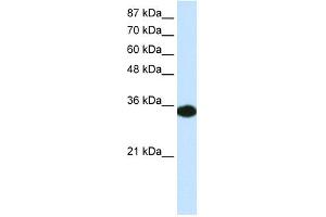 WB Suggested Anti-HOXD4 Antibody Titration: 0.