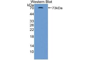 Western blot analysis of the recombinant protein. (INHBB antibody  (AA 50-404))