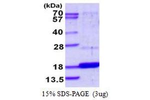 SDS-PAGE (SDS) image for Dual Specificity Phosphatase 23 (DUSP23) (AA 1-150) protein (His tag) (ABIN667982) (DUSP23 Protein (AA 1-150) (His tag))