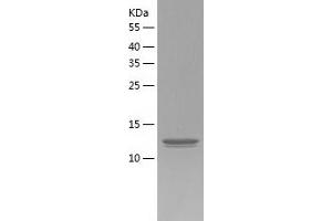 Western Blotting (WB) image for Thioredoxin Domain Containing 12 (Endoplasmic Reticulum) (TXNDC12) (AA 27-172) protein (His tag) (ABIN7284771) (TXNDC12 Protein (AA 27-172) (His tag))