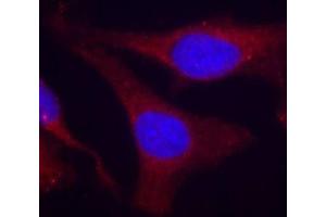 Immunofluorescence staining of methanol-fixed HeLa cells using Phospho-PTPN6-Y536 antibody (ABIN2988271). (SHP1 antibody  (pTyr536))