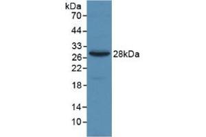 Figure. (alpha 2 Macroglobulin antibody  (AA 616-856))