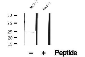 Western blot analysis of extracts of MCF-7 cells, using UQCRFS1 antibody. (UQCRFS1 antibody  (C-Term))