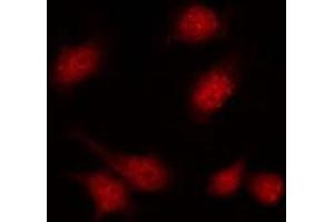 ABIN6275357 staining A549 by IF/ICC. (PIP5K1C antibody  (Internal Region))