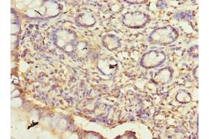 Immunohistochemistry of paraffin-embedded human small intestine tissue using ABIN7165103 at dilution of 1:100 (ARMCX6 antibody  (AA 28-300))