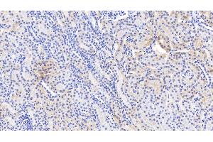 Detection of SCNN1a in Human Kidney Tissue using Polyclonal Antibody to Amiloride Sensitive Sodium Channel Subunit Alpha (SCNN1a) (SCNN1A antibody  (AA 112-543))