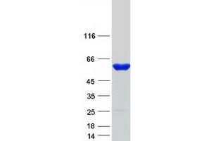 Validation with Western Blot (PFKFB1 Protein (Myc-DYKDDDDK Tag))