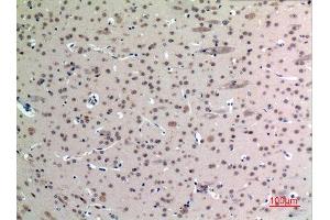 Immunohistochemistry (IHC) analysis of paraffin-embedded Mouse Brain, antibody was diluted at 1:100. (FGF12 antibody  (Internal Region))