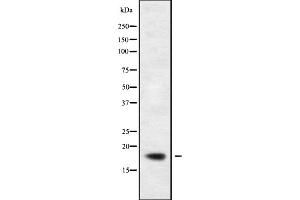 Western blot analysis of KLRC2/4 using HeLa whole cell lysates (KLRC2/4 antibody)