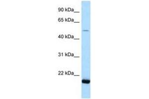 Image no. 1 for anti-seryl-tRNA Synthetase 2, Mitochondrial (SARS2) (AA 108-157) antibody (ABIN6747848) (SARS2 antibody  (AA 108-157))