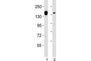 Western blot testing of KDM6A antibody at 1:2000 dilution. (KDM6A antibody  (AA 1041-1074))