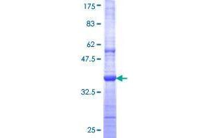 Image no. 1 for Tripartite Motif Containing 58 (TRIM58) (AA 346-445) protein (GST tag) (ABIN1323717) (TRIM58 Protein (AA 346-445) (GST tag))