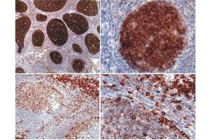 Immunohistochemistry of paraffin-embedded sections Immunohistochemistry staining (paraffin-embedded sections) using anti-Cbp/PAG (MEM-255). (PAG1 antibody  (AA 97-432))
