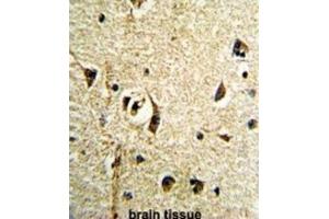 Immunohistochemistry (IHC) image for anti-Fat Mass and Obesity-Associated (FTO) antibody (ABIN3002909) (FTO antibody)