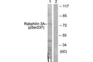 Western blot analysis of extracts from RAW264. (RPH3A antibody  (pSer237))