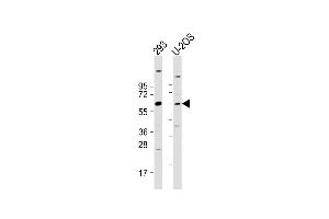 TRIM6 anticorps  (N-Term)