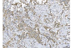 IHC analysis of ATX2/ATXN2 using anti-ATX2/ATXN2 antibody (ABIN3043507). (Ataxin 2 antibody  (C-Term))
