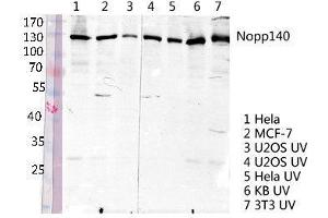Western Blot (WB) analysis of specific lysis using Nopp140 Polyclonal Antibody. (NOLC1 antibody  (C-Term))