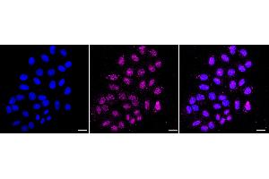 Immunocytochemical staining of HepG2 cells with TCEB2 antibody (ABIN7800584), 1:1,000).