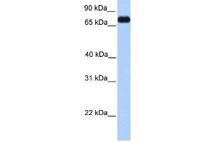 WB Suggested Anti-PRICKLE3 Antibody Titration:  0. (PRICKLE3 antibody  (C-Term))