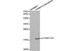 Western blot analysis of extracts from 293 cells, using Phospho-STMN1-S16 antibody. (Stathmin 1 antibody  (pSer16))