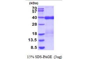 SDS-PAGE (SDS) image for Tumor Necrosis Factor Receptor Superfamily, Member 10c (TNFRSF10C) (AA 26-236) protein (His tag) (ABIN5854192)