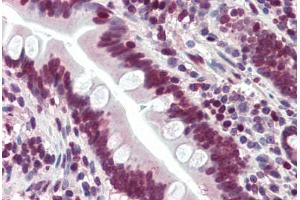 Human Small Intestine (formalin-fixed, paraffin-embedded) stained with LASS6 antibody ABIN396945 at 5 ug/ml followed by biotinylated goat anti-rabbit IgG secondary antibody ABIN481713, alkaline phosphatase-streptavidin and chromogen. (CERS6 antibody  (N-Term))